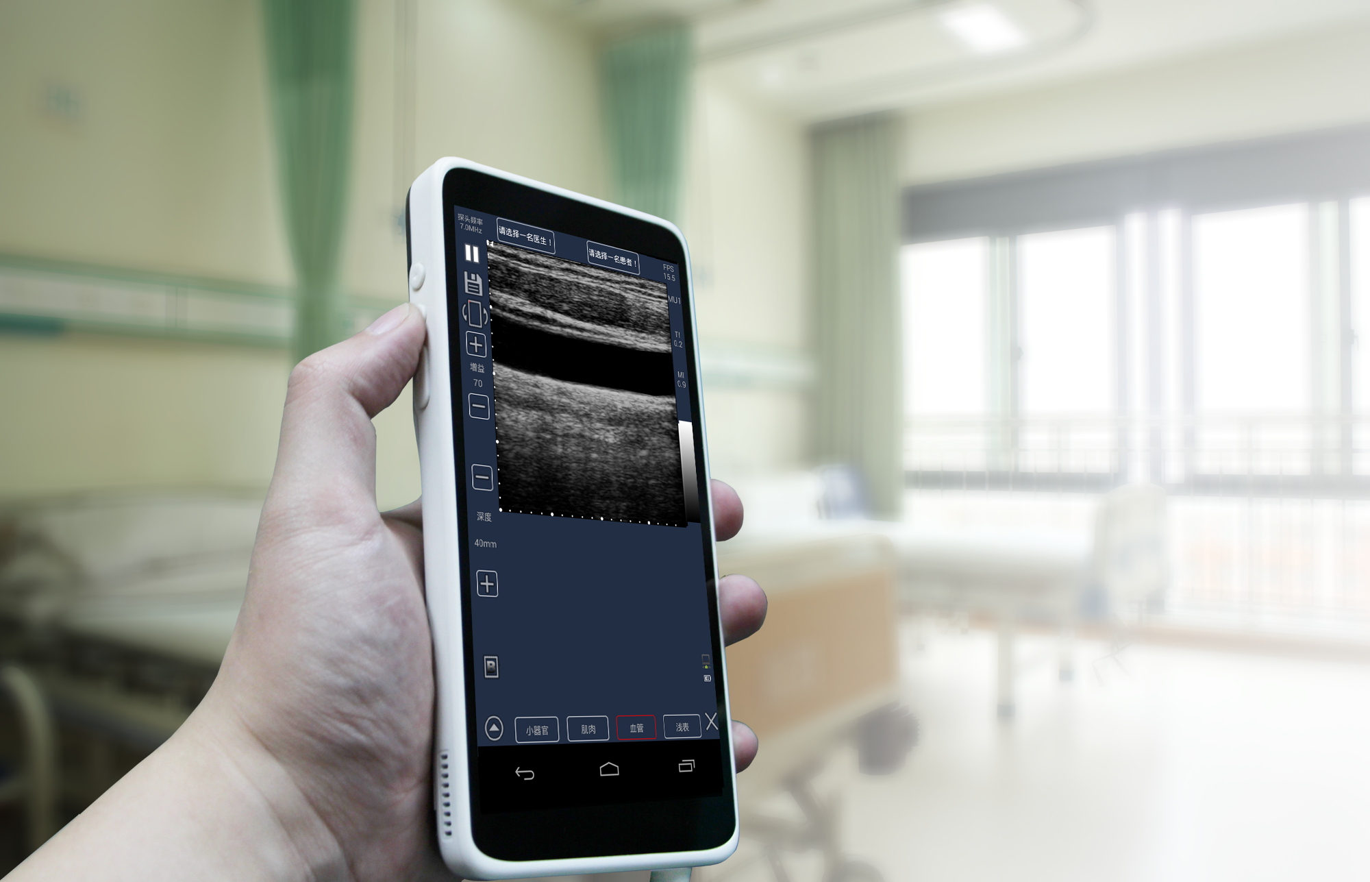 Ultrasound Scanner 6 inch 128 Elements Handheld Touch Screen Color Doppler Machine with convex/linear probe