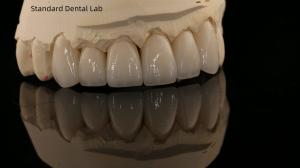 Wholesale Full Contour Zirconia Crown and High Aesthetic Natural Dental Bridge 5 Year Guarantee from china suppliers