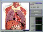 3d Nls Health Analyzer Machine
