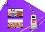 Painless ND YAG Laser Tattoo Removal Machine 1064nm / 532nm Wavelength