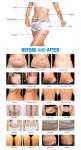Non Invasive Lipo Laser Slimming Machine 5 Wavelength 808nm Infrared Body