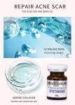 Luxury Youth Serum Injection Mesotherapy Red Spots Skin Acne Injection Treatment