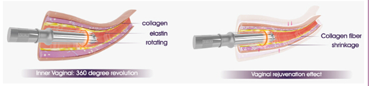 30W Co2 Fractional Laser System Tightening CO2 Laser Machines