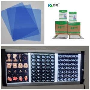 Wholesale 150 Microns Inkjet X Ray Film Printing Speed 1-3 Minutes For Medical 10inch from china suppliers