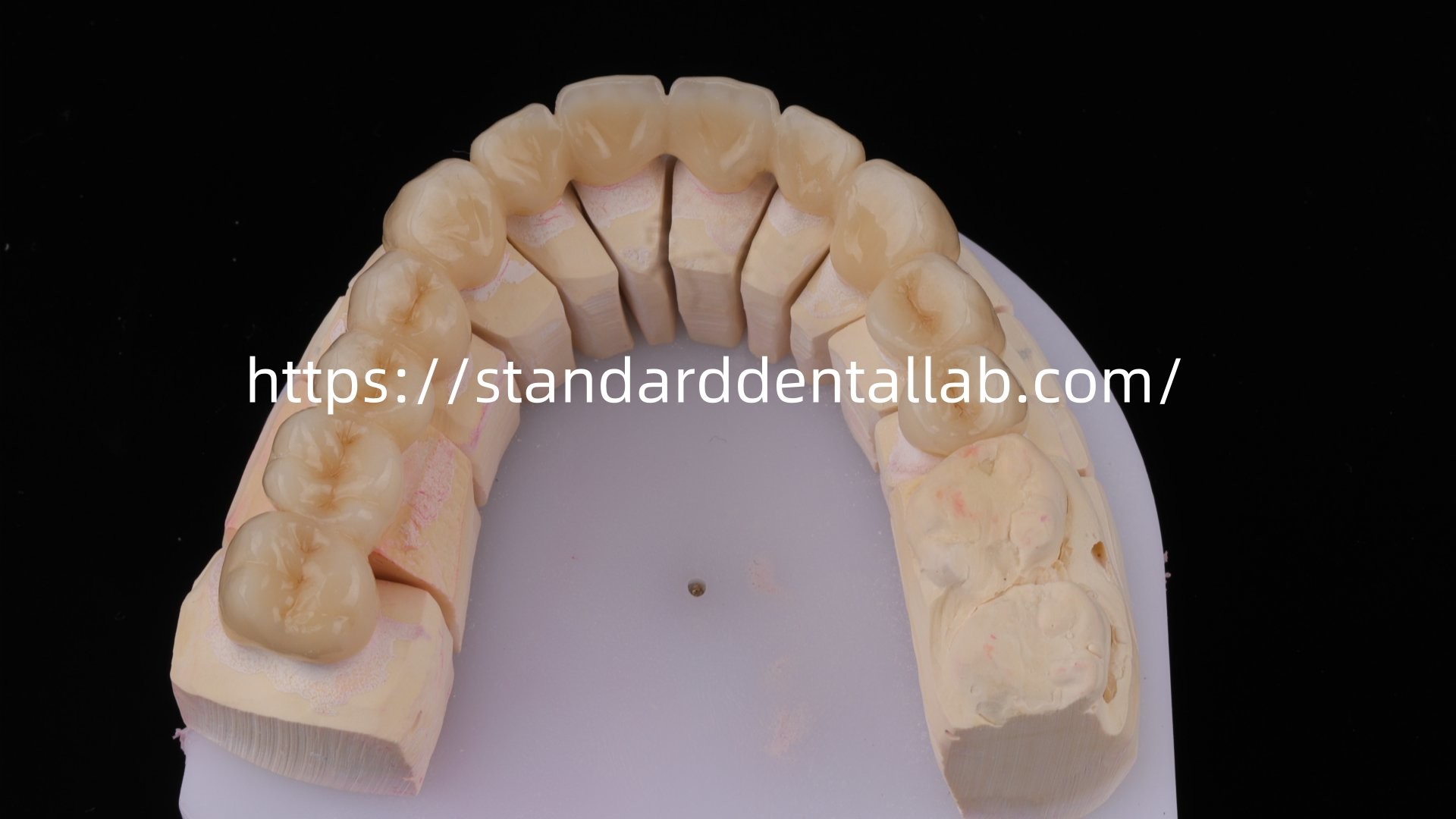 Highly Durable And Natural-Looking Layered Porcelain For Layered Dental Zirconia Crown China Dental Lab