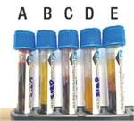 Clotted Blue Top Cbc Vacutainer Blood Tube , Blood Sample Collection Vials