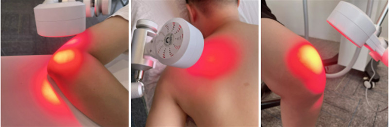 100-300 Khz Air Cooling Magneto Therapy Machine Sport Injuries Joint Pain Relief Physio