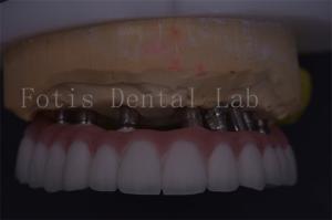 Wholesale Customizable Silver Dental Crown Precision Fit For Comfortable Restoration from china suppliers