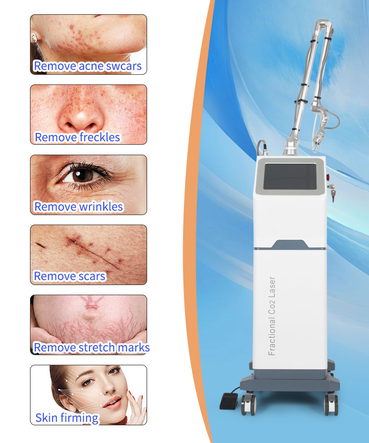 Effective Fractional Laser Machine for Wrinkle Reduction and Skin Tightening