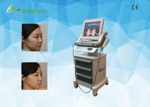 Wholesale 2 years warranty Medical HIFU face lift machine /4.5mm hifu face and neck lift from china suppliers