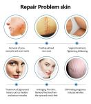 CO2 Fractional Laser Scar Pigment Removal Vaginal Tightenin Device
