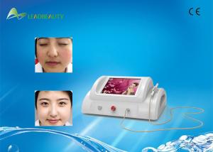 Wholesale Portable 30MHz spider vein removal blood vessel removal machine from china suppliers