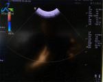 GE 8C Ultrasound Probe Repair For Lens Replacement Original