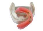 High Biological Inter Miscibility Denture Dental Lab Safety Implant
