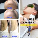 Painless YAG IPL Diode Laser Device Portable 755 808 1064nm Laser Hair Removal
