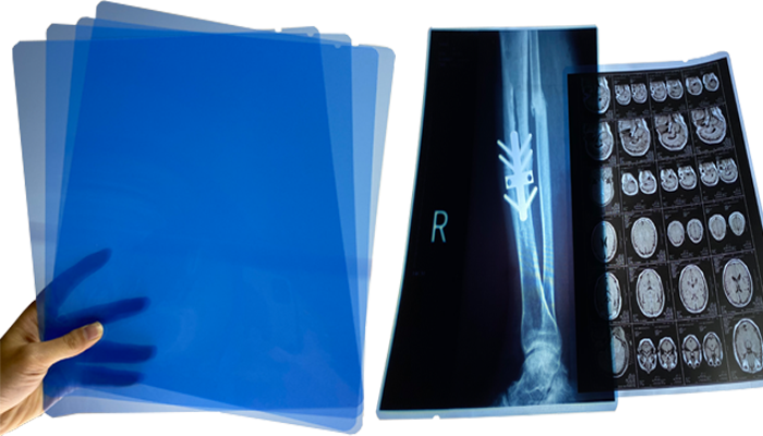 Healthcare PET Based X Ray Medical Imaging Film Waterproof Transparent