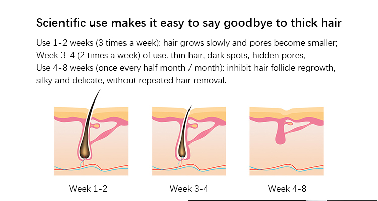 Inface Epilator Hair Laser Removal 900000 Flash IPL Permanent Painless Women Body Removal Hair Machine