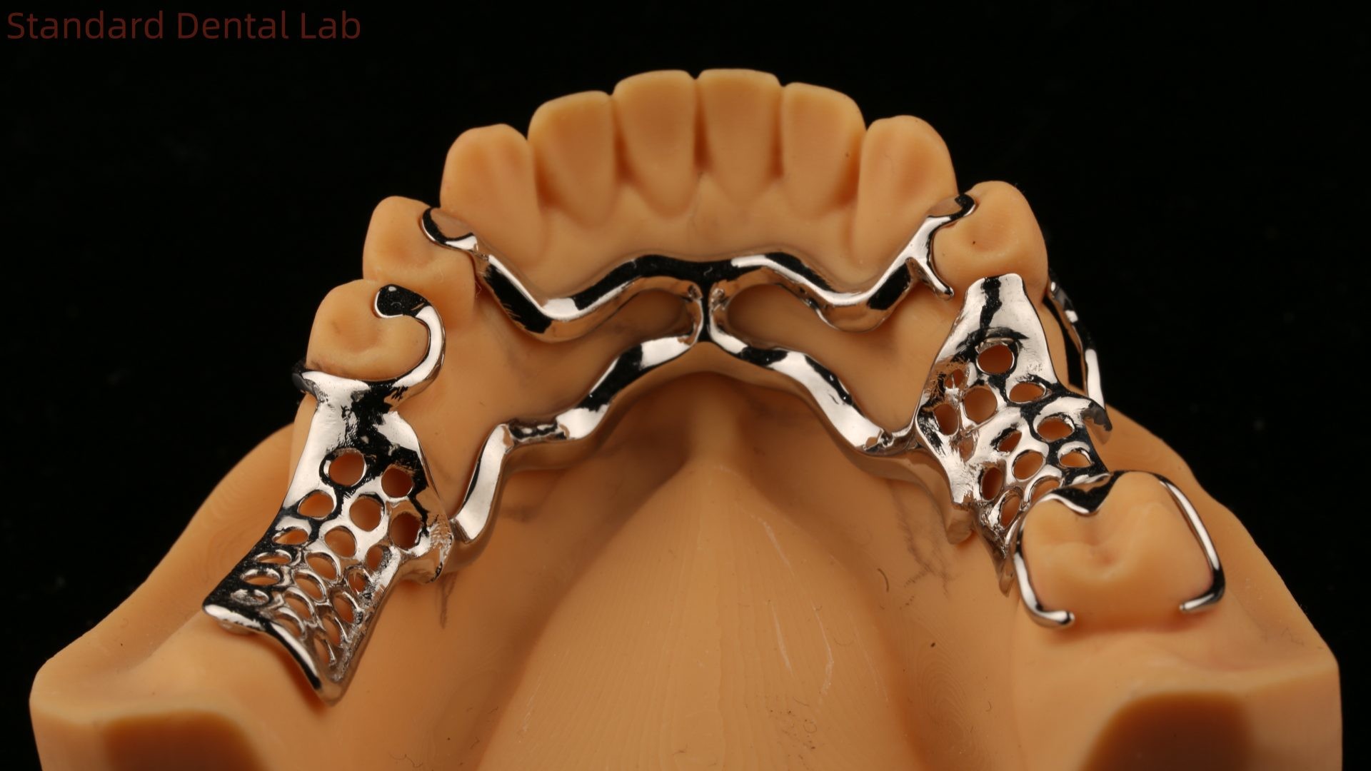 Upper Cast Metal Framework Partial Dentures Strong Lightweight And Durable