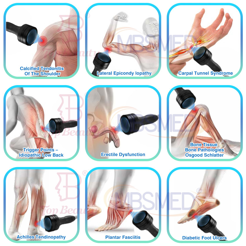 Focal Focus Shockwave Soft Shock Wave Eswt Physiotherapy Device