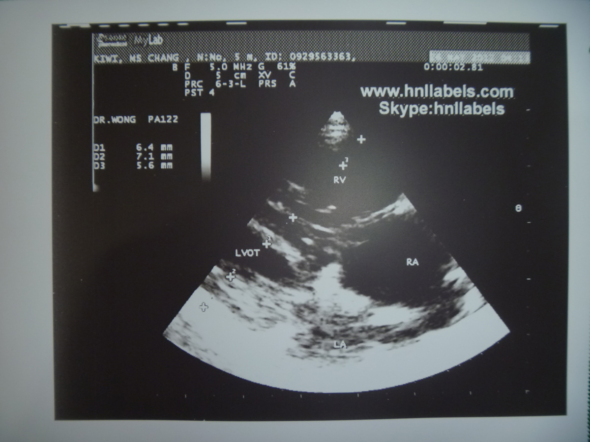 upp-110s,sony ultrasound paper, sony upp-110s