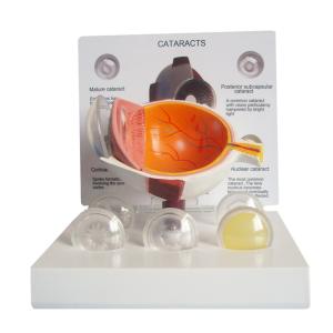 Wholesale Medical Science Anatomy Type Human Pathology Eye Model For Display Education from china suppliers