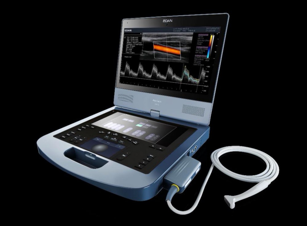 Edan AX4 Laptop 3D/4D Color Doppler Ultrasound scanner