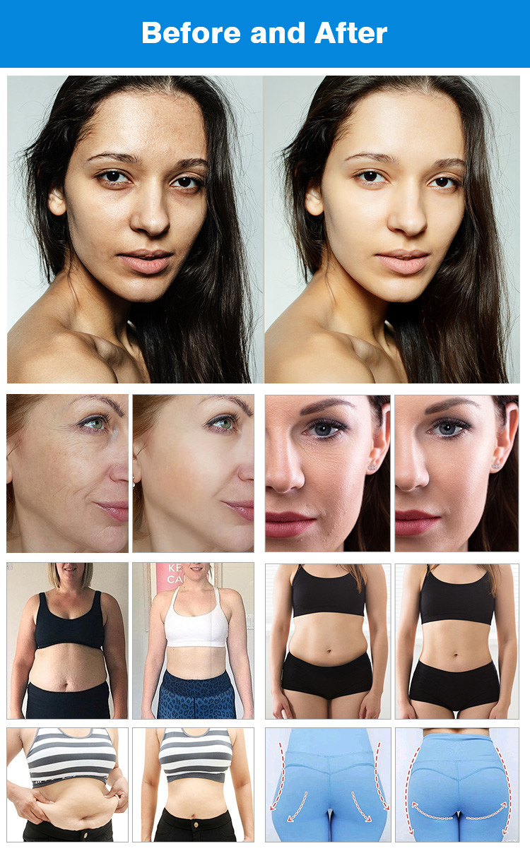 Clinic Abdominal Fat Contouring Machine , Non Surgical Body Shaping Machine