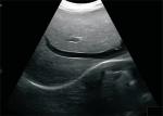Digital Portable Mobile Laptop Ultrasound Scanner Medical Equipment BIO 3000J