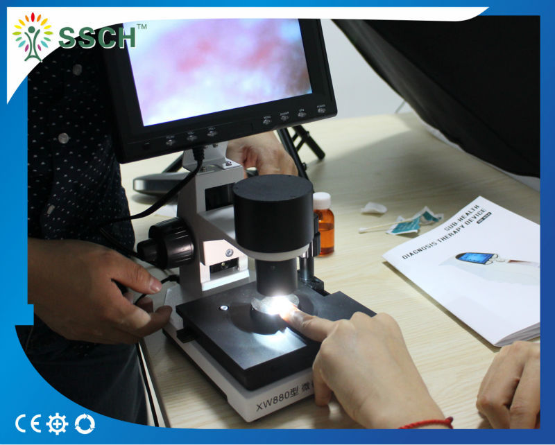 CE Approved LCD Screen Medical Microscope Capillary Microcirculation