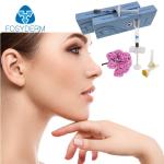 Hyaluronic Acid Dermal Lip Fillers Dermal Filler Facial Crosslinked