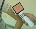 Lcd Monitor Digital Video Otoscope Ophthalmoscope For Clinical Inspection Of