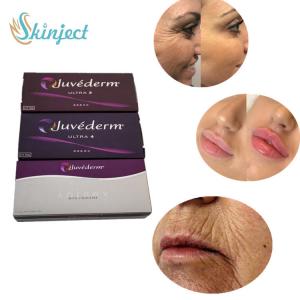 Wholesale Juvederm Ultra 4 Dermal Filler Lip Injections For Sexy Lips Enhancement from china suppliers