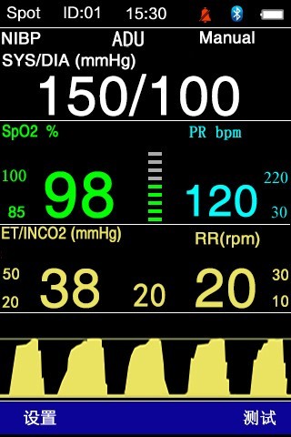 Spo2 NIBP EtCO2 Vital Sign Monitor