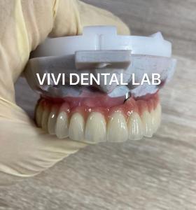 Wholesale Scheftner Ivoclar Porcelain Fused Metal Crowns Dental SLM Technique from china suppliers