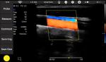 House Handheld Doppler Device Ultrasound Like A Cellphone Size 12 Months