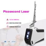 Laser tattoo removal q-switched nd:yag laser carbon peel/Q switched nd yag laser