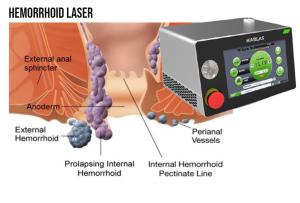 Wholesale Dual Wavelength Medical Diode Laser from china suppliers