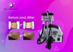 Weight Reduction RF Cavitation Slimming Machine Skin Tightening Beauty Machine