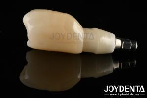 Wholesale Shoulder Margin Design Dental Implant Bars For Wide Prosthetic Platform Needs from china suppliers