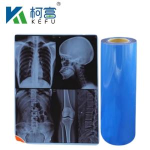 Wholesale Waterproof Medical X-Ray Thermal Film X Ray Blue Film For Inkjet Printers from china suppliers