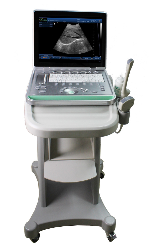 PC based 3D Ultrasound Machine SS-9 Laptop Ultrasound scanner