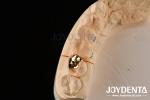 Abrasive Resistance Dental Wax Casting FMC Crown For Oral Clinical Repair