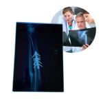 Thermal Medical Dry Printer CT Printer Inkjet Film Blue A4 PET Orthopedic