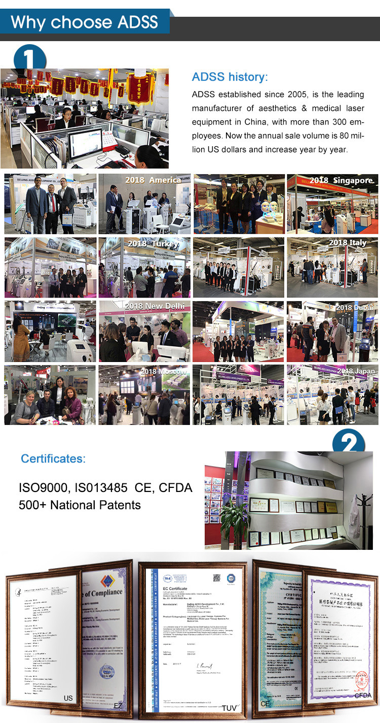 CE DPL Laser Machine Skin Rejuvenation Acne Pigmentation Treatment Machine