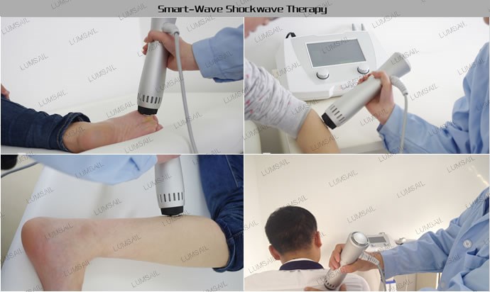 shock wave therapy equipment osteoprosis rehabiitation heel synovitis