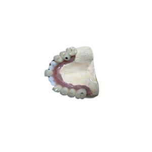 Wholesale Accurate Biocompatibility Dental Implant Attachments Tooth Implant Crown from china suppliers