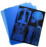 Low Fog Medical X Ray Film With 320dpi Resolution 14 x 17 on Led X Ray Film View