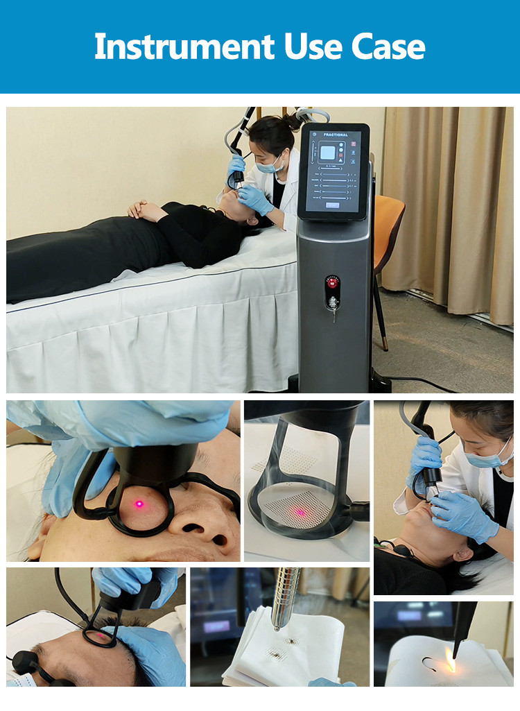 10600nm CO2 Fractional Laser Machine With 7 Joints Arm Scar / Wrinkle Removal Vaginal Treatment