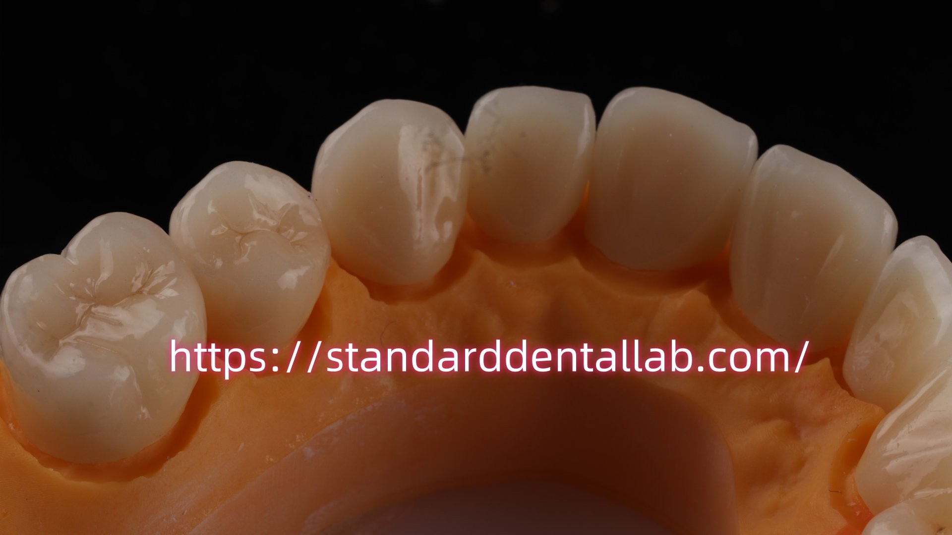 Layered Dental Zirconia Crown And Bridge Translucency 3D PRO Zirconia Porcelain Crown Standard Dental Lab