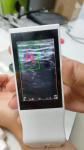 Medical Wifi Ultrasound Machine Android Portable Wireless Ultrasound Probe